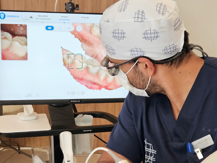 Scanner intraoral