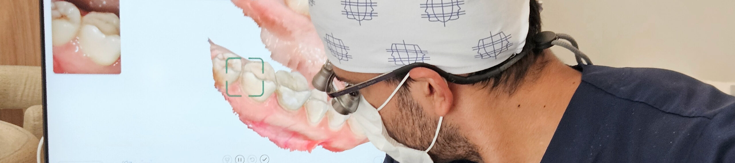 Scanner intraoral