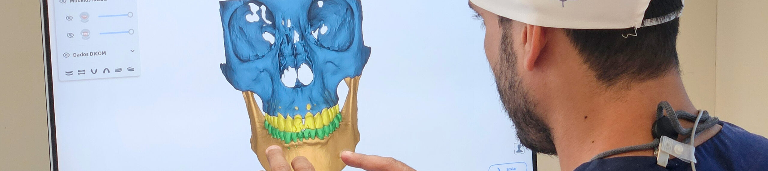 Tomografia 3D
