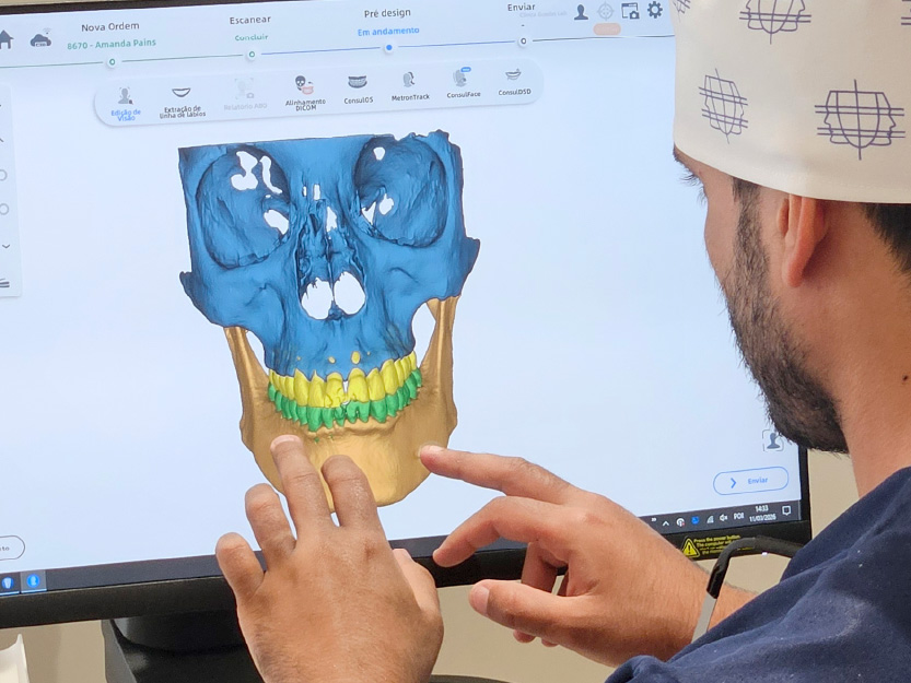 Tomografia 3D